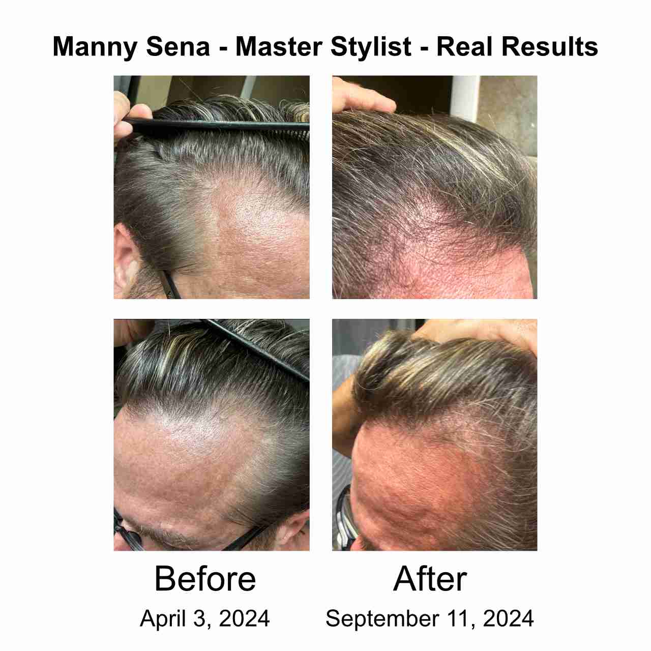 Manny's Before and Afters Manny Sena's real results after using Awaken for only 5 months