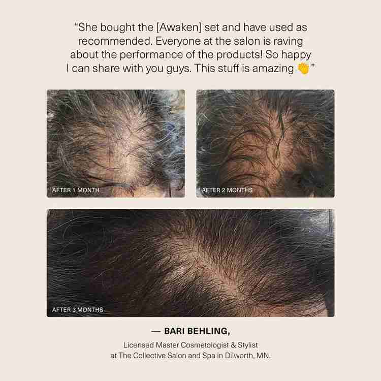 Surface_0224_AwakenTestimonial_750x Awaken Therapeutic Hair Results by Surface